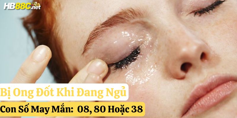tự nhiên bị ong đốt đánh con gì hb88