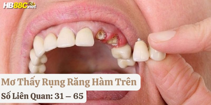 nằm mơ thấy rụng răng tốt hay xấu hb88